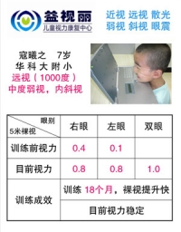 摘镜明星：远视1000度，内斜视