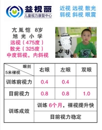 摘镜明星：远视475度，散光325度，内斜视