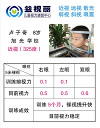 康复明星：近视325度
